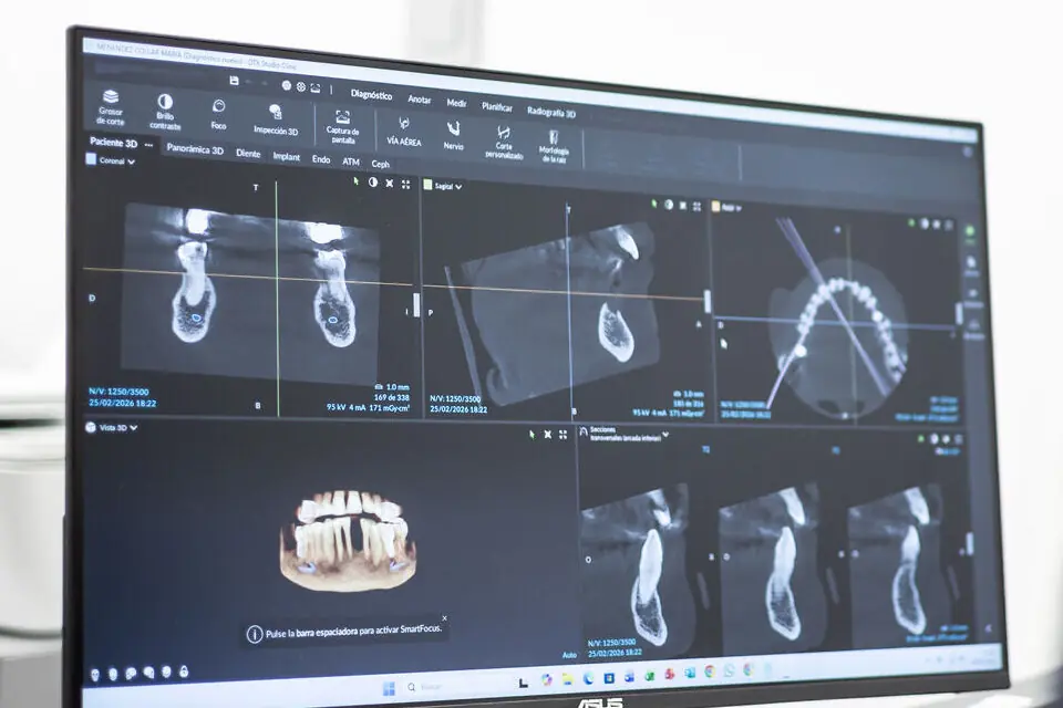 La radiografía en tres dimensiones en la pantalla de la consulta